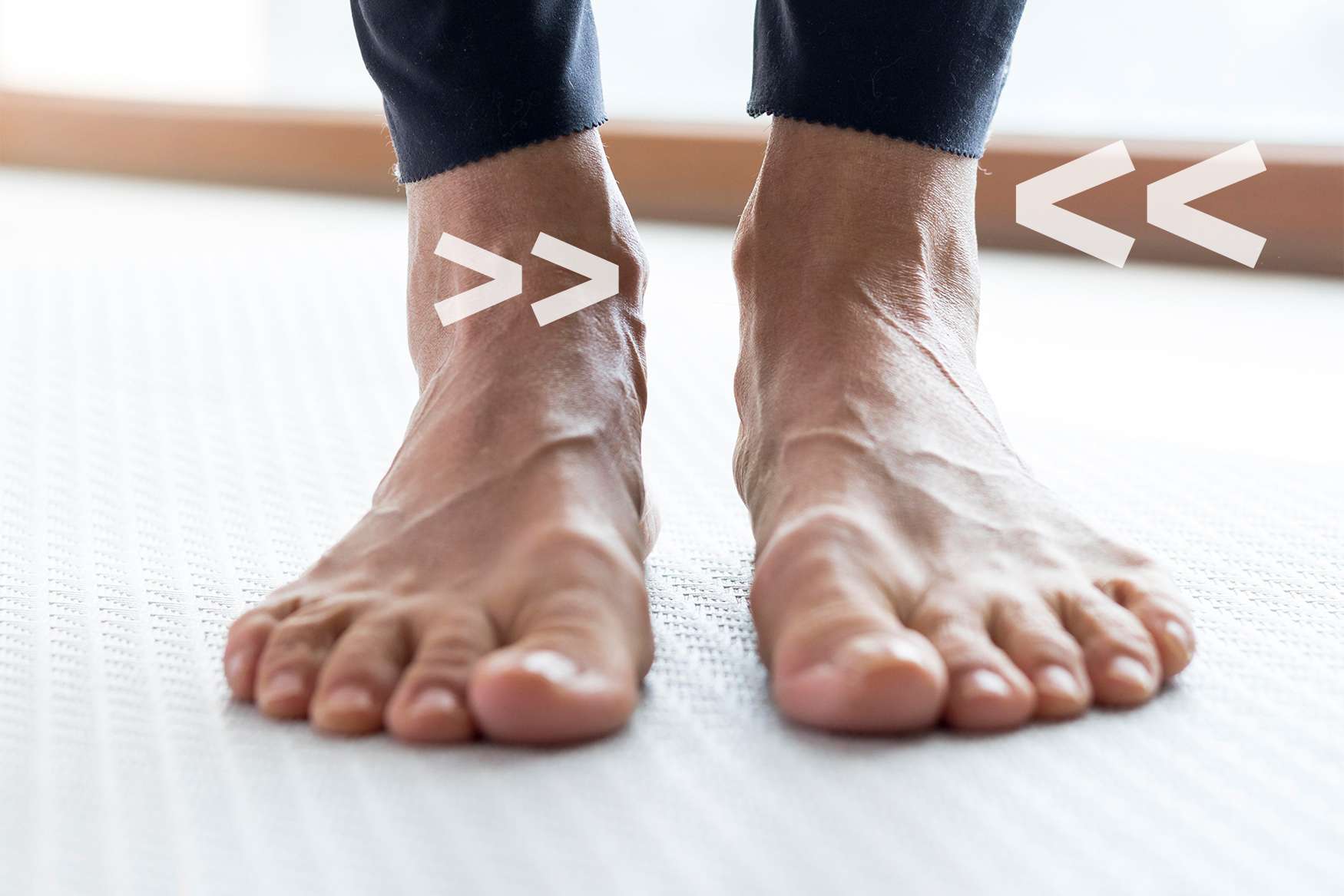 Fußfehlstellung – wann orthopädische Maßschuhe erforderlich sind.